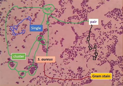 Staphylococcus Aureus Gram Stain Introduction Principle Procedure