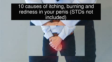 10 Causes Of Itching Burning And Redness In Your Penis Stds Not