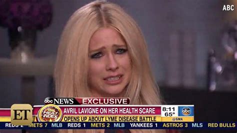 Avril Lavigne On Lyme Disease Battle The Worst Time In My Life La Times
