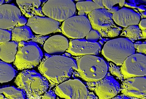 Fat Cells Photograph By Kevin Mackenzie University Of Aberdeen