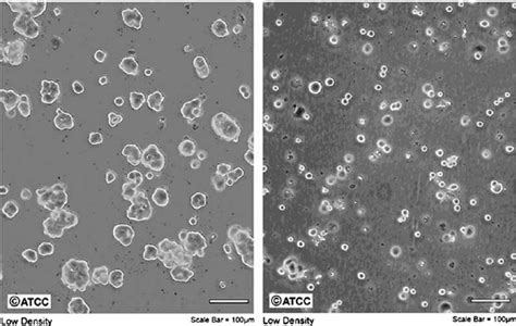 My cell culture has failed to attach. Photos of MCF-7 cells (left) and SKBr3 cells (right) (ATCC ...