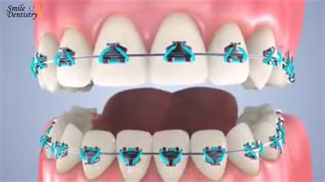 Orthodontics Youtube