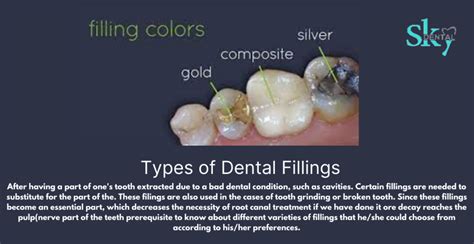 Dental Fillings And Its Types Of Variations Sky Dental Hospital