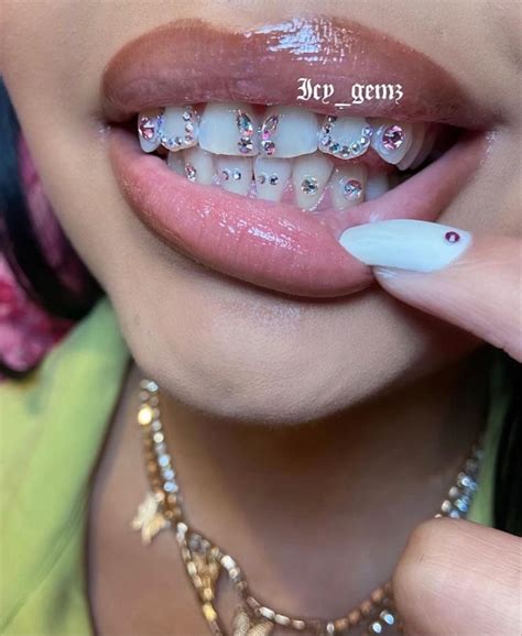 Pin On TOOTHGEMS