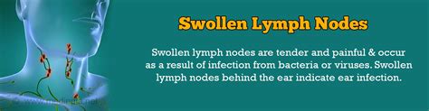 Swollen Lymph Nodes Lymphadenopathy Causes Symptoms Diagnosis