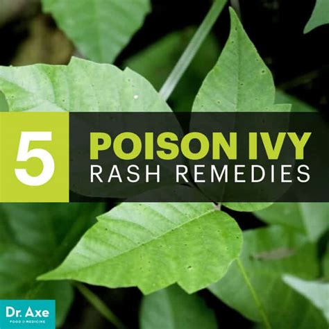 Top 5 Natural Remedies For Poison Ivy Rash Dr Axe