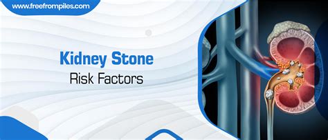 Kidney Stone Risk Factors What You Need To Know