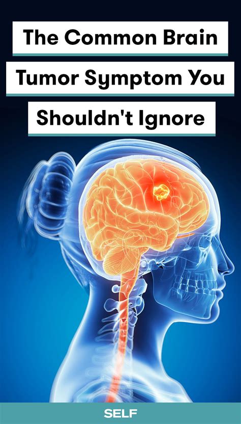 Signs For Brain Tumor Brainlyve