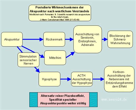 Hellbrauner stuhlgang ⇒ experten klären auf: Rückenschmerzen was bringen Spritzen und Akupunktur