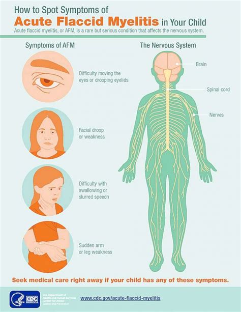 Officials Investigating 252 Possible Cases Of Polio Like Illness Afm