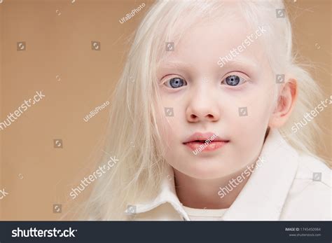 Closeup Portrait Little Caucasian Girl Albinism Stock Photo 1745450984