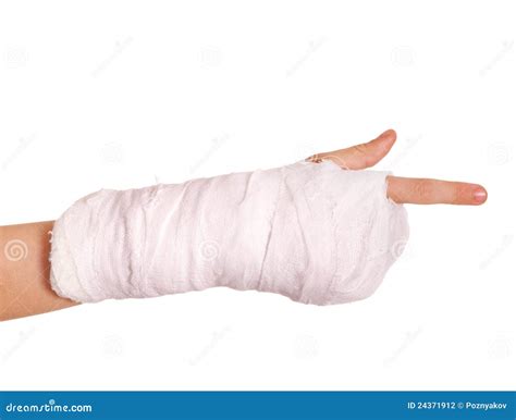 Broken Arm In A Cast Stock Photography Image 24371912