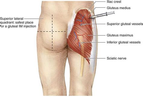 Get inspired by our community of talented artists. How to inject Testosterone (TRT) into your glutes - Dosage ...