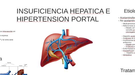 Insuficiencia Hepatica E Hipertension Portal Enfermedad Hepatica