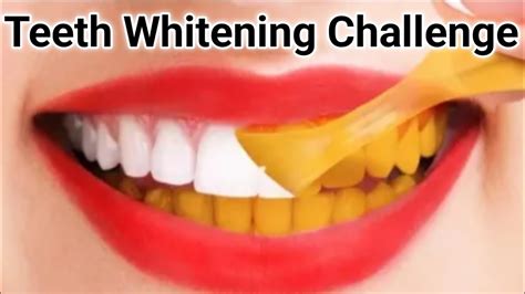 Teeth Whitening At Home 100 Easy And Effective How To Whiten Teeth At