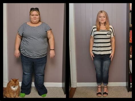 Weight Gain After Gastric Bypass Surgery Ways To Fix It Bariatric