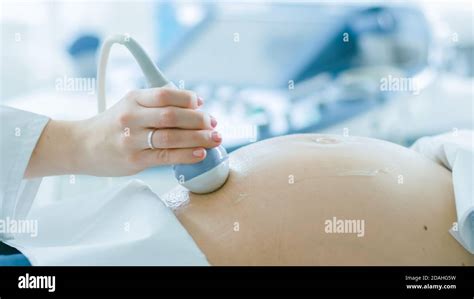 In The Hospital Close Up Shot Of The Doctor Doing Ultrasound Sonogram Scan To A Pregnant Woman