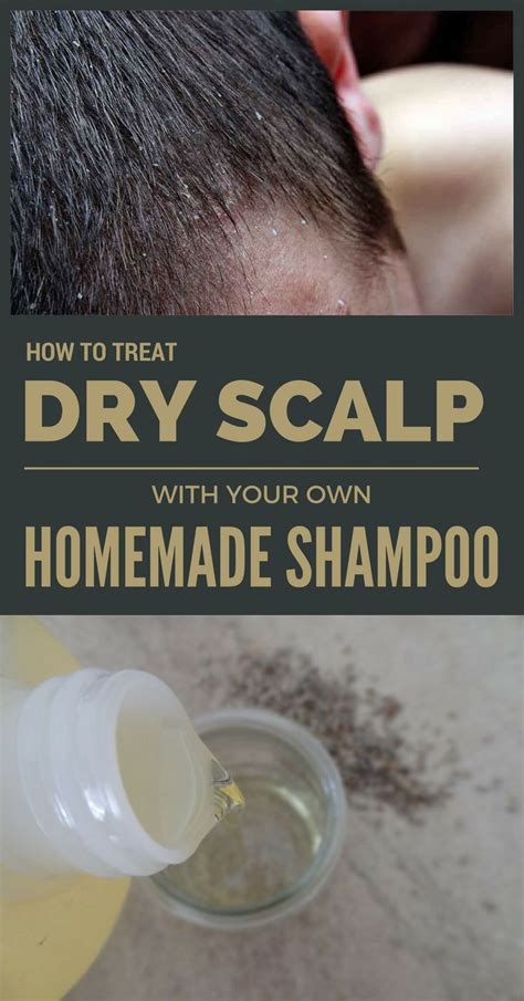 How To Treat Dry Scalp With Your Own Homemade Shampoo Shampoo Ideas