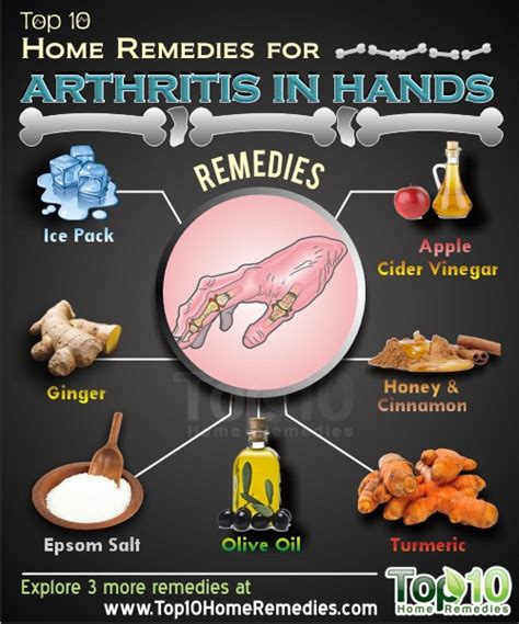 Home Remedies For Arthritis In Hands Top 10 Home Remedies