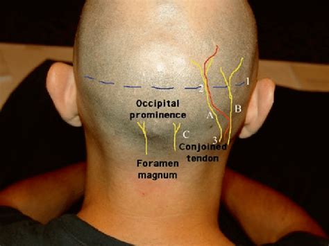 Anatomy Of The C And C Nerve Roots Gon Greater Occipital Nerve My XXX