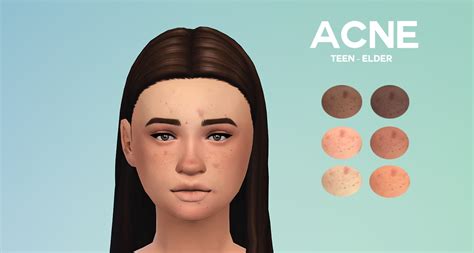 Boredsimblr Acne Sims 4 Sims 4 Cc Skin Sims