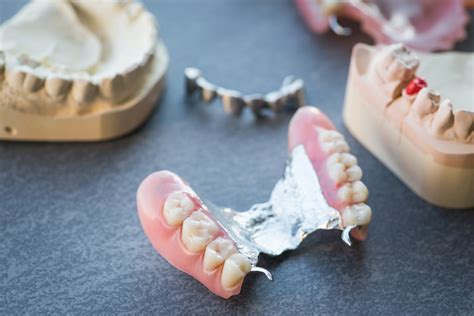 Advantages And Disadvantages Linked To Partial Dentures