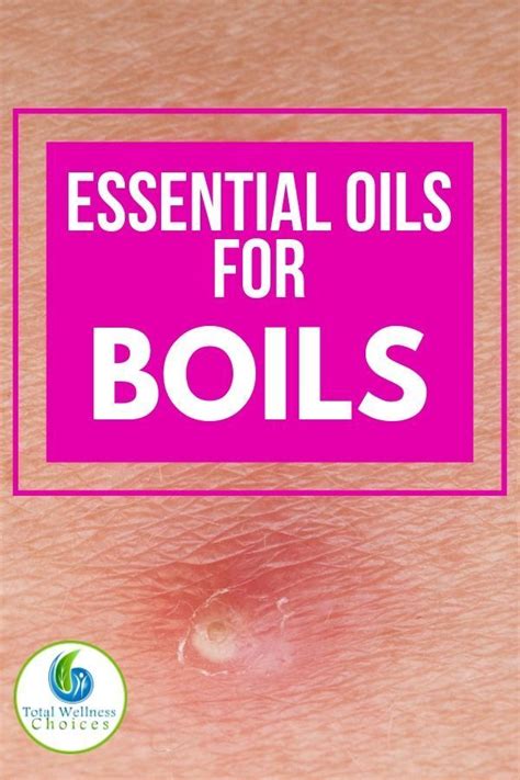 Top 5 Essential Oils For Boils Essential Oil For Boils Essential