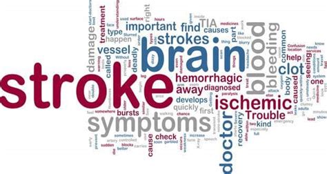 Stroke 15 Risk Factors You Should Know