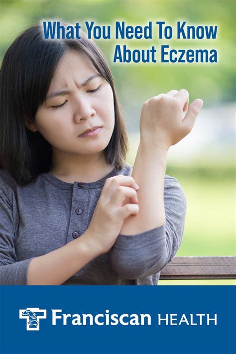 Understanding Eczema Atopic Dermatitis Franciscan Health