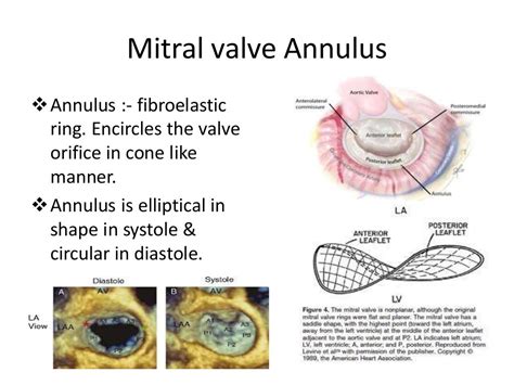 Assessment Of Mitral Valve By Tee