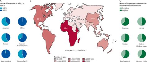First Estimates Of The Global And Regional Incidence Of Neonatal Herpes
