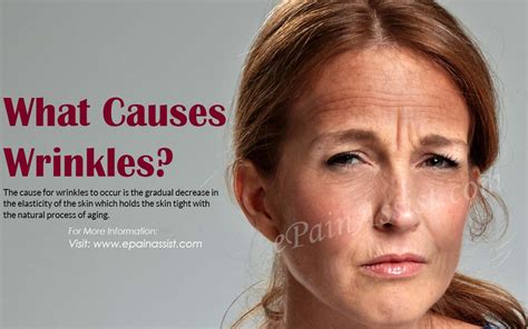 What Causes Wrinkles8 Best Home Remedies For Wrinkles