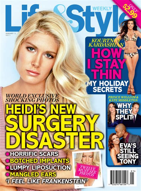 Heidi Montag Reacts To Her Life And Style Plastic Surgery Scars Cover