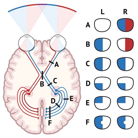 Peripheral Visual Fields Cranial Nerves Medschool