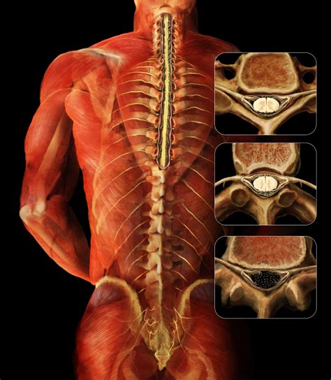 Read these 8 tips to develop a bigger and more defined back! Common Back and Leg Pain Treatments that WORK, says, Dr. Norman Marcus | Los Angeles Public ...