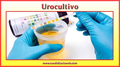Blog De Universidad Estudio Microbiol Gico De La Orina Urocultivo