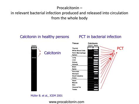Ppt A Service Evaluation Of Procalcitonin After Prorata Powerpoint