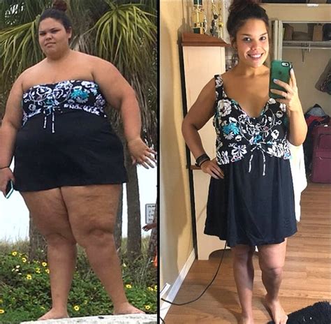 25 Amazing Before And After Weight Loss Pics That Are Hard To Believe