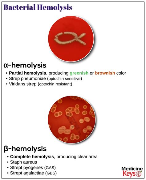 Bacterial Hemolysis Medicine Keys For Mrcps