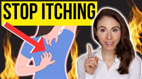 How To Stop Itching On The Back Notalgia Paresthetica Youtube