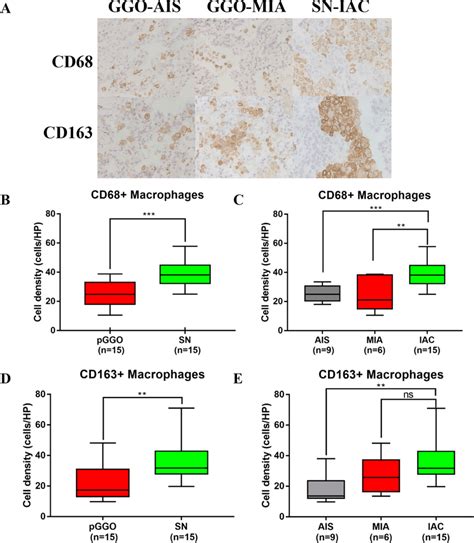 Assessment Of Cd68 Tumor Associated Macrophages Tams And