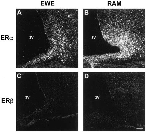 low power darkfield photomicrographs of the arcuate nucleus in a ewe a download scientific