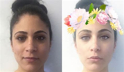 Snapchat Dysmorphia Selfies Are Driving Us To Plastic Surgery