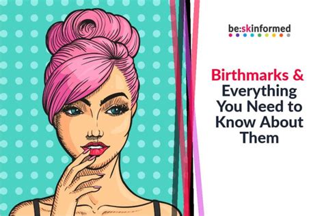 Birthmarks And Everything You Need To Know About Them Beskinformed
