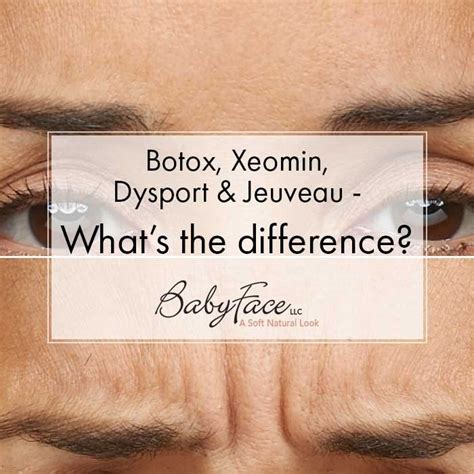 The Difference Between Botox Xeomin Dysport And Jeuveau — Top Rated