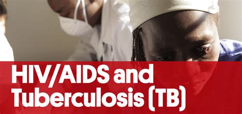vih aids and tuberculosis isglobal