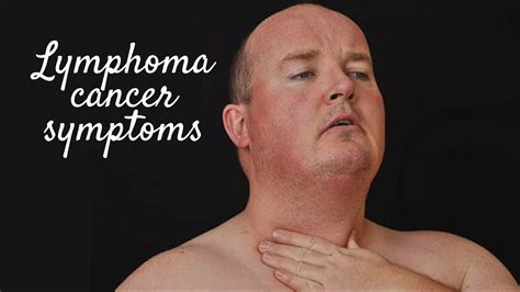 Lymphoma Cancer Symptoms Youtube
