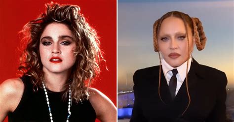 Inside Madonnas Facial Transformation Through The Years Photos