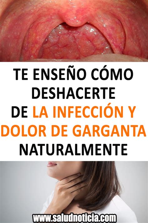 Te Enseño Cómo Deshacerte De La Infección Y Dolor De Garganta