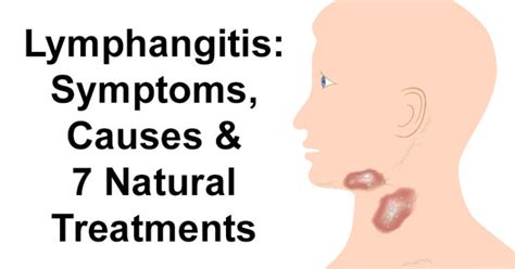 Lymphangitis Symptoms Causes And 7 Natural Treatments David Avocado Wolfe
